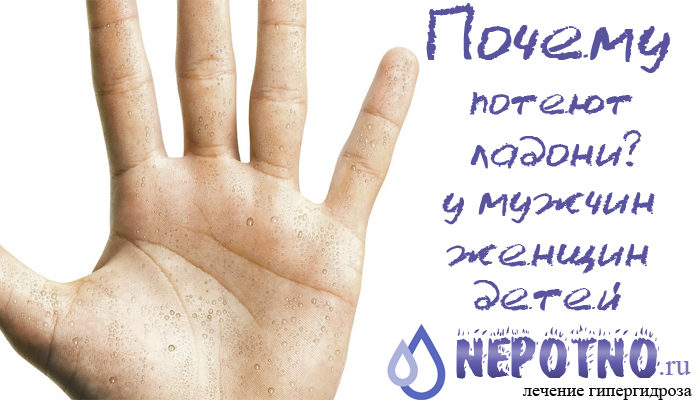 почему потеют ладони
