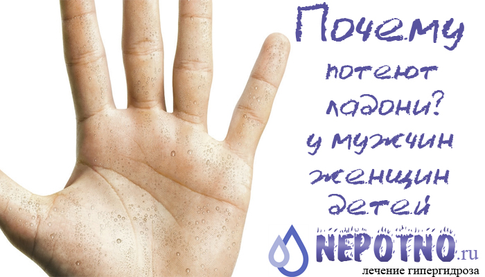 почему потеют ладони